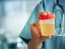 Arti Perubahan Warna & Bau Urine: Penyebab dan Solusinya